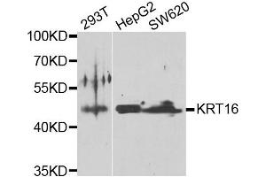 Western blot analysis of extracts of various cell lines, using KRT16 antibody.