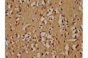 IHC image of ABIN7176072 diluted at 1:300 and staining in paraffin-embedded human brain tissue performed on a Leica BondTM system. (ZIM2 antibody  (AA 1-124))