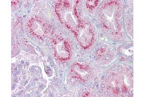 Anti-P2RX2 / P2X2 antibody IHC of human kidney. (P2RX2 antibody  (AA 108-157))