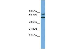 WB Suggested Anti-YY1AP1  Antibody Titration: 0. (YY1AP1 antibody  (Middle Region))