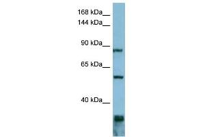 WB Suggested Anti-EPS8 Antibody Titration: 0. (EPS8 antibody  (Middle Region))