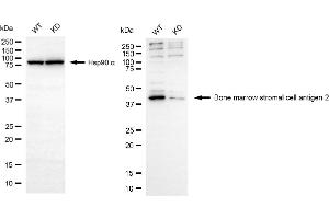 Western blotting analysis using bone marrow stromal cell antigen 2 antibody (ABIN7797773). (Recombinant BST2 antibody)