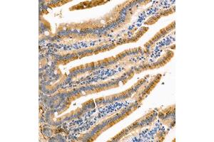 Immunohistochemistry of paraffin embedded mouse small intestine using APOA4 (ABIN7073084) at dilution of 1:1200 (300x lens) (APOA4 antibody)