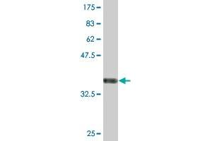 Western Blot detection against Immunogen (36. (POLR3B antibody  (AA 2-100))