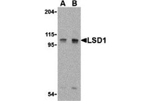 Western Blotting (WB) image for anti-Lysine (K)-Specific Demethylase 1A (KDM1A) (Middle Region) antibody (ABIN1030990) (LSD1 antibody  (Middle Region))