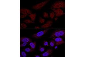 Immunofluorescence (IF) image for anti-WW Domain Containing Transcription Regulator 1 (WWTR1) (AA 1-230) antibody (ABIN6150278)