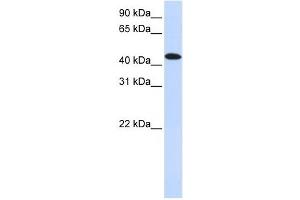 MKNK2 antibody used at 1 ug/ml to detect target protein. (MKNK2 antibody  (N-Term))