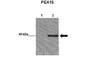 WB Suggested Anti-PEA15 Antibody  Positive Control: Lane 1:241 µg EGFP-transfected MCF7 lysate Lane 2: 041 µg EGFP-PEA15 transfected MCF7 lysate Primary Antibody Dilution: 1:0000Secondary Antibody: Goat anti-rabbit-HRP Secondry  Antibody Dilution: 1:0000Submitted by: Yann Wallez (Sanford-Burnham Medical Research Institute) (PEA15 antibody  (C-Term))