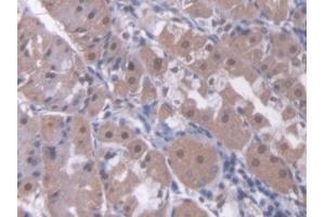 Detection of RARb in Human Stomach Tissue using Polyclonal Antibody to Retinoic Acid Receptor Beta (RARb) (Retinoic Acid Receptor beta antibody  (AA 205-451))