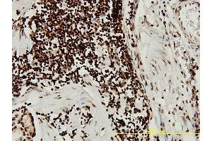 Immunoperoxidase of monoclonal antibody to SGK on formalin-fixed paraffin-embedded human stomach tissue. (SGK1 antibody  (AA 1-431))