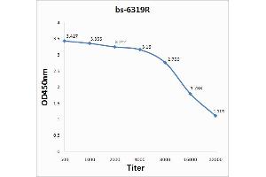 Lane 1: mouse brain lysates Lane 2: mouse intestine lysates probed with Anti IL-1 BETA/IL-1B Polyclonal Antibody, Unconjugated (ABIN872644) at 1:200 in 4 °C. (IL-1 beta antibody  (AA 161-269))