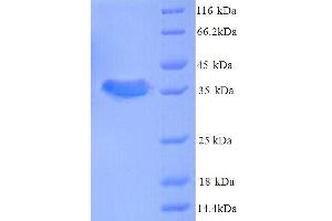 Acyl Carrier Protein (AcpP) (AA 1-77), (full length) protein (His tag)