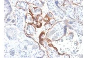 Formalin-fixed, paraffin-embedded human placenta stained with hCG beta Rabbit Recombinant Monoclonal Antibody (HCGb/1985R). (Recombinant CGB antibody)
