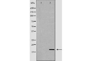 Western blot analysis of extracts of mouse spleen , using AIF1 antibody. (Iba1 antibody  (C-Term))