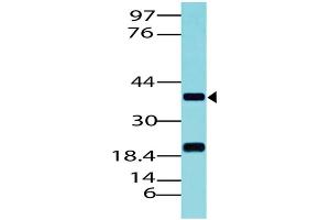 Image no. 1 for anti-Paired Box 5 (PAX5) (AA 102-339) antibody (ABIN5027431) (PAX5 antibody  (AA 102-339))