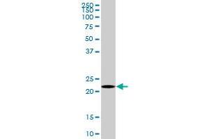 HEMK2 MaxPab polyclonal antibody. (N6AMT1 antibody  (AA 1-186))