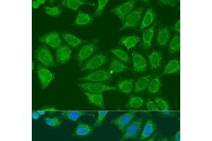 Immunofluorescence analysis of U2OS cells using ADH7 Polyclonal Antibody at dilution of 1:100. (ADH7 antibody)