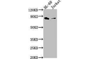 Western Blot Positive WB detected in: HL-60 whole cell lysate, Jurkat whole cell lysate All lanes: ELMO1 antibody at 1:2000 Secondary Goat polyclonal to rabbit IgG at 1/50000 dilution Predicted band size: 84, 29, 50 kDa Observed band size: 84 kDa