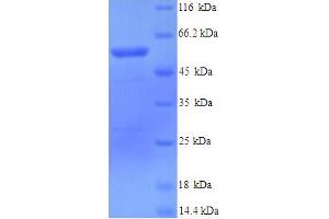 SDS-PAGE (SDS) image for Lysyl Oxidase-Like 1 (LOXL1) (AA 95-607) protein (His tag) (ABIN5713614) (LOXL1 Protein (AA 95-607) (His tag))