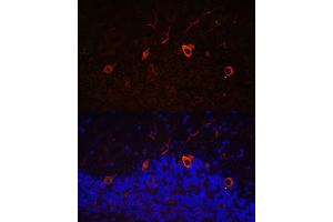 Immunofluorescence analysis of mouse brain using K antibody (ABIN7268068) at dilution of 1:100. (KAL1 antibody  (AA 200-300))