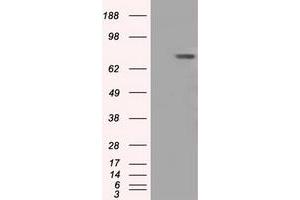 Western Blotting (WB) image for anti-Bruton Agammaglobulinemia tyrosine Kinase (BTK) antibody (ABIN1496975) (BTK antibody)