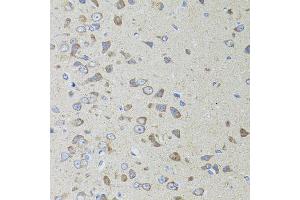Immunohistochemistry of paraffin-embedded rat brain using AIFM3 antibody (ABIN5996156) at dilution of 1/100 (40x lens).