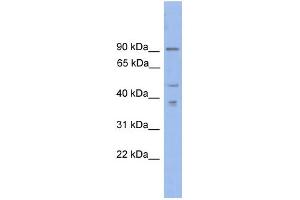 WB Suggested Anti-ZFX Antibody Titration:  0.