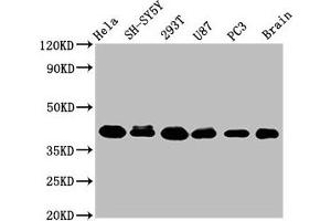 Western Blot Positive WB detected in: Hela whole cell lysate, SH-SY5Y whole cell lysate, 293T whole cell lysate, U87 whole cell lysate, PC-3 whole cell lysate, Rat brain tissue All lanes: KTI12 antibody at 3. (KTI12 antibody  (AA 110-204))