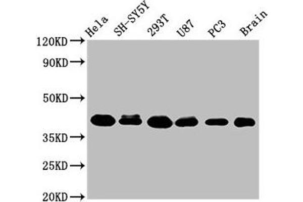 KTI12 antibody  (AA 110-204)