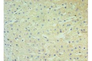 Immunohistochemistry of paraffin-embedded human liver tissue using ABIN7145678 at dilution of 1:100 (BST2 antibody  (AA 49-161))