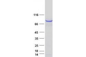 RAD18 Protein (Myc-DYKDDDDK Tag)