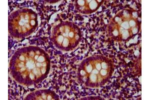 FCHO1 antibody  (AA 45-180)