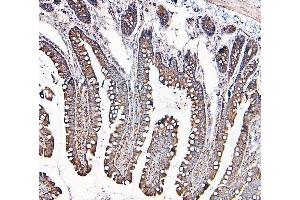 IHC analysis of MVP using anti-MVP antibody (ABIN7600481).