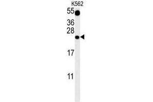 TFAM Antibody (C-term) western blot analysis in K562 cell line lysates (35 µg/lane). (TFAM antibody  (C-Term))