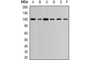Western blot analysis of USP16 expression in Jurkat (A), NIH3T3 (B), COS7 (C), mouse heart (D), mouse spleen (E), rat brain (F) whole cell lysates. (USP16 antibody)