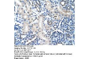 Rabbit Anti-LOR Antibody  Paraffin Embedded Tissue: Human Kidney Cellular Data: Epithelial cells of renal tubule Antibody Concentration: 4. (LOR antibody  (N-Term))