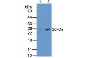 Western blot analysis of (1) Human Liver Tissue and (2) Human Serum. (MBL2 antibody  (AA 130-248))