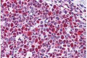 Immunohistochemistry (Formalin-fixed Paraffin-embedded Sections) (IHC (fp)) image for anti-High Mobility Group Box 1 (HMGB1) (AA 1-91) antibody (ABIN574269)