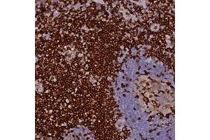 Immunohistochemical staining of human tonsil with FYB polyclonal antibody ( Cat # PAB28030 ) shows strong cytoplasmic positivity at 1:50 - 1:200 dilution. (FYB antibody)