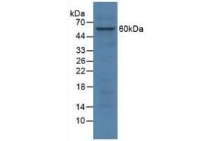 Detection of SGSH in Human HepG2 Cells using Polyclonal Antibody to N-Sulfoglucosamine Sulfohydrolase (SGSH) (SGSH antibody  (AA 21-389))