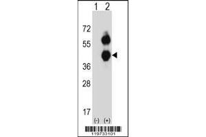 Western blot analysis of BCAT2 using rabbit polyclonal BCAT2 Antibody using 293 cell lysates (2 ug/lane) either nontransfected (Lane 1) or transiently transfected (Lane 2) with the BCAT2 gene. (BCAT2 antibody  (C-Term))