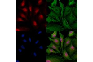 ABIN6257563 and ABIN6274180 staining  cells by IF/ICC.
