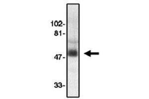 Image no. 1 for anti-Chemokine (C-C Motif) Receptor 8 (CCR8) (AA 183-201), (Extracellular Loop) antibody (ABIN265001) (CCR8 antibody  (Extracellular Loop))