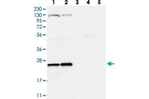 Western blot analysis of Lane 1: RT-4, Lane 2: U-251 MG, Lane 3: Human Plasma, Lane 4: Liver, Lane 5: Tonsil with ARL4C polyclonal antibody  at 1:250-1:500 dilution.