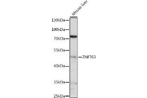ZNF763 anticorps  (AA 315-370)