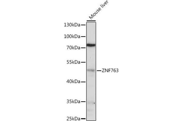 ZNF763 antibody  (AA 315-370)