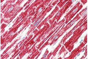 Human Heart: Formalin-Fixed, Paraffin-Embedded (FFPE) (SRR antibody)