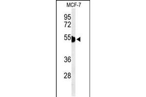 Western blot analysis of KRT1 Antibody in MCF-7 cell line lysates (35ug/lane) (Cytokeratin 1 antibody  (AA 415-443))