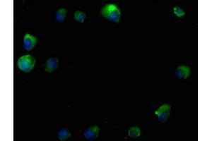 Immunofluorescence staining of MCF-7 cells with ABIN7140114 at 1:50, counter-stained with DAPI. (RTN4RL2 antibody  (AA 355-372))