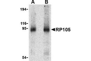 Western Blotting (WB) image for anti-CD180 Molecule (CD180) (Middle Region) antibody (ABIN1031073) (CD180 antibody  (Middle Region))